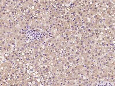 Immunohistochemistry-Paraffin: CTR2 Antibody [NBP2-97266]