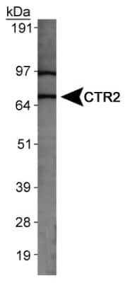 Western Blot: CTR2 AntibodyBSA Free [NBP1-05199]