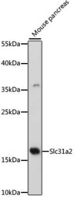 Western Blot: CTR2 AntibodyAzide and BSA Free [NBP2-92317]