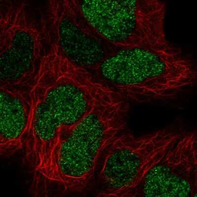 Immunocytochemistry/ Immunofluorescence: CTR9 Antibody [NBP2-57251]