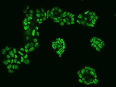 Immunocytochemistry/ Immunofluorescence: CTR9 Antibody [NBP2-97398]