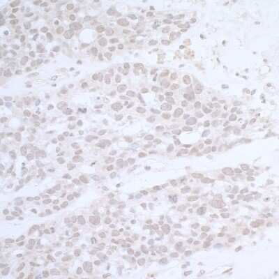 Immunohistochemistry: CTR9 Antibody [NB100-68205]