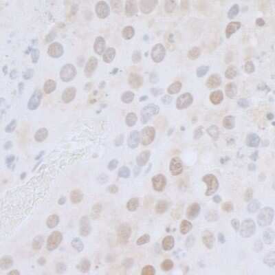 Immunohistochemistry: CTR9 Antibody [NB100-68205]