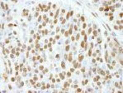 Immunohistochemistry-Paraffin: CTR9 Antibody [NB100-68205]