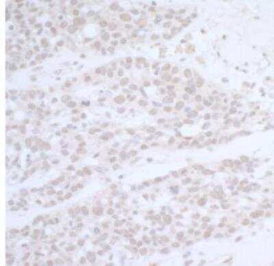 Immunohistochemistry-Paraffin: CTR9 Antibody [NB100-68205]