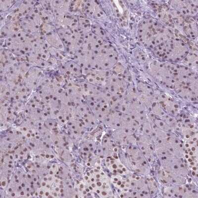 Immunohistochemistry-Paraffin: CTR9 Antibody [NBP2-49547]