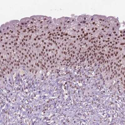 Immunohistochemistry-Paraffin: CTR9 Antibody [NBP2-49547]