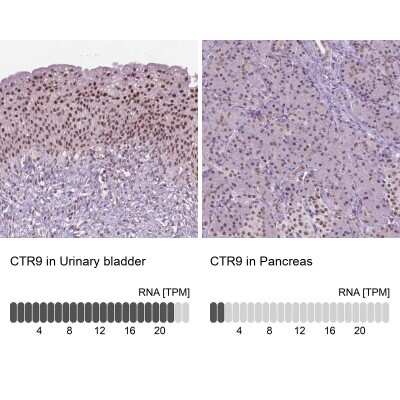 Immunohistochemistry-Paraffin: CTR9 Antibody [NBP2-49547]