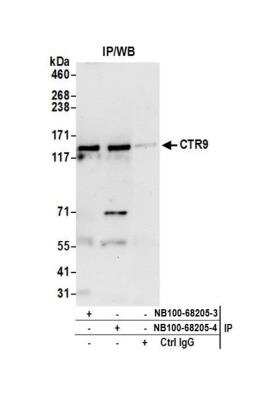 Immunoprecipitation: CTR9 Antibody [NB100-68205]