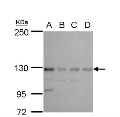 Western Blot: CTR9 Antibody [NBP2-16031]