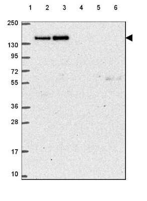 Western Blot: CTR9 Antibody [NBP2-49547]