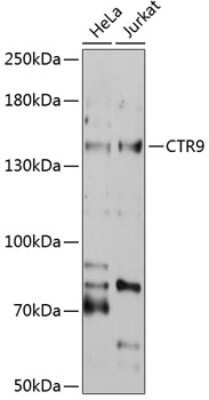 Western Blot: CTR9 AntibodyAzide and BSA Free [NBP3-04381]