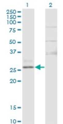 Western Blot: CTRB1 Antibody (3C8) [H00001504-M02]