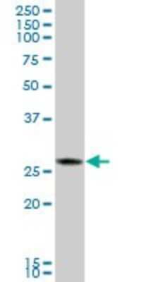 Western Blot: CTRB1 Antibody [H00001504-B01P]