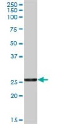 Western Blot: CTRB1 Antibody [H00001504-B02P]