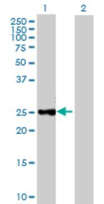 Western Blot: CTRB1 Antibody [H00001504-B02P]