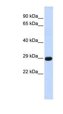 Western Blot: CTRB1 Antibody [NBP1-62678]