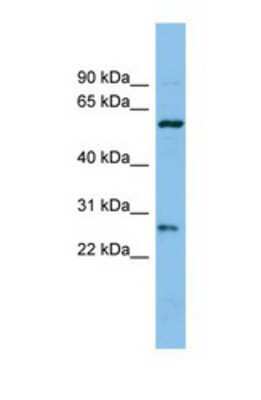 Western Blot: CTRB1 Antibody [NBP1-69669]