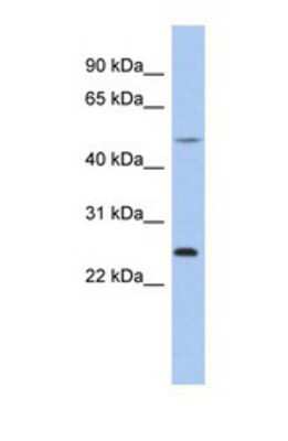 Western Blot: CTRB1 Antibody [NBP1-69699]