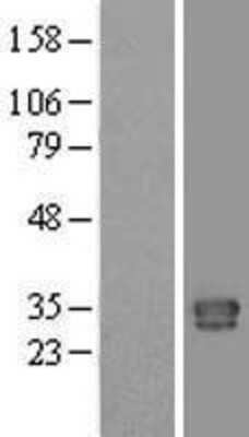 Western Blot: C1qTNF1/CTRP1 Overexpression Lysate [NBL1-08341]