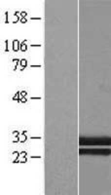 Western Blot: C1qTNF1/CTRP1 Overexpression Lysate [NBL1-08342]