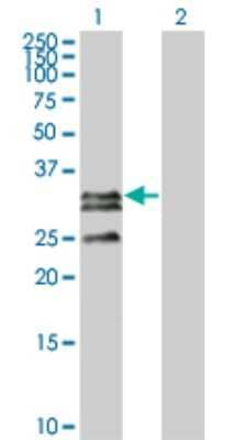 Western Blot: CTRP2 Antibody (1D7-2C7) [H00114898-M01]