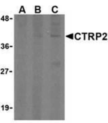 Western Blot: CTRP2 AntibodyBSA Free [NBP1-76627]