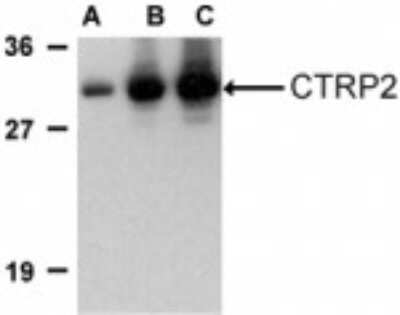 Western Blot: CTRP2 AntibodyBSA Free [NBP1-76671]