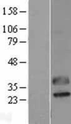 Western Blot: CTRP2 Overexpression Lysate [NBL1-08343]