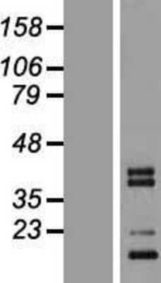 Western Blot: C1qTNF3/CORS26/CTRP3 Overexpression Lysate [NBP2-04922]