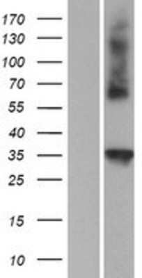 Western Blot: C1qTNF4/CTRP4 Overexpression Lysate [NBP2-06105]