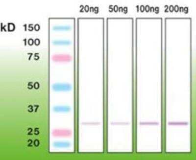 Western Blot: C1qTNF5/CTRP5 Antibody (A14-A) [NBP1-30131]