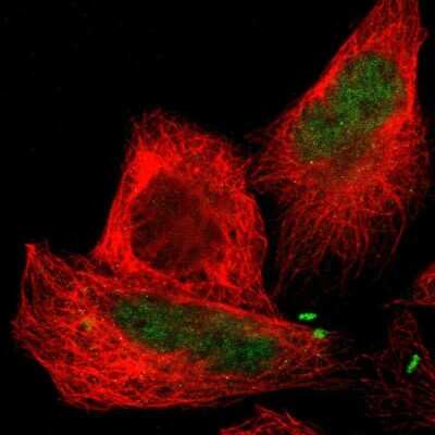 Immunocytochemistry/ Immunofluorescence: CTRP6 Antibody [NBP1-85381]