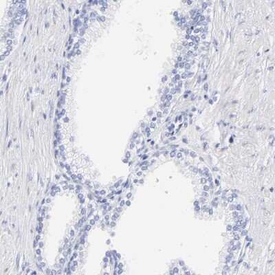 Immunohistochemistry-Paraffin: CTRP6 Antibody [NBP1-85381]