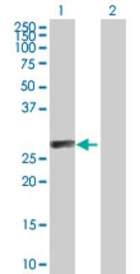 Western Blot: CTRP6 Antibody [H00114904-B01P]