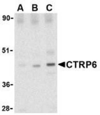 Western Blot: CTRP6 AntibodyBSA Free [NBP1-76633]