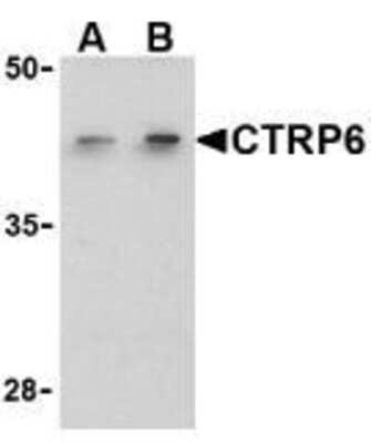 Western Blot: CTRP6 AntibodyBSA Free [NBP1-77218]