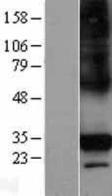 Western Blot: CTRP6 Overexpression Lysate [NBL1-08345]