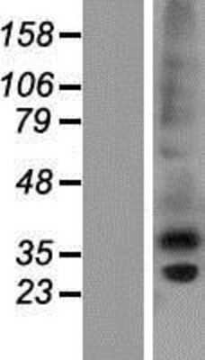 Western Blot: CTRP6 Overexpression Lysate [NBP2-04866]