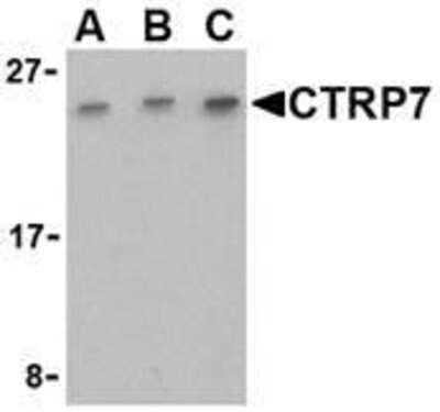 Western Blot: CTRP7 AntibodyBSA Free [NBP1-76634]