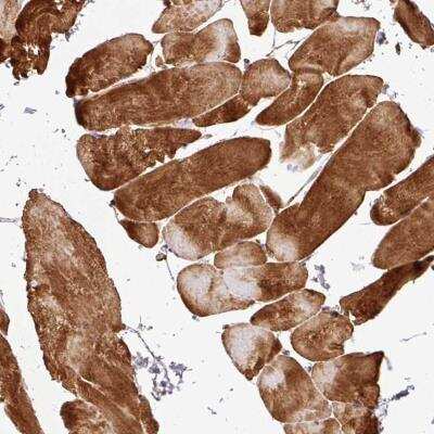 Immunohistochemistry-Paraffin: CTRP9/C1qTNF9 Antibody [NBP2-46834]