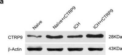 Western Blot: CTRP9/C1qTNF9 Antibody [NBP2-46834]