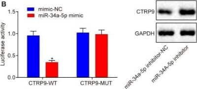 Western Blot: CTRP9/C1qTNF9 Antibody [NBP2-46834]