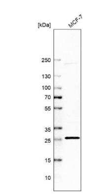 Western Blot: CTRP9/C1qTNF9 Antibody [NBP2-46834]