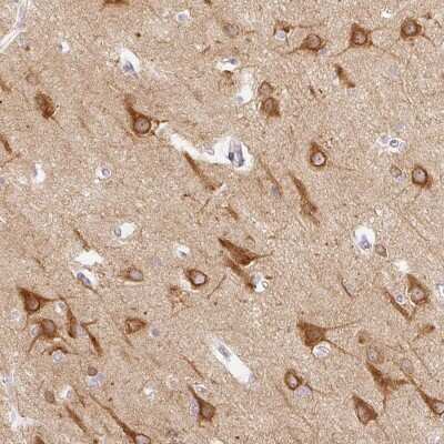 Immunohistochemistry-Paraffin: CTTNBP2 Antibody [NBP2-32030]