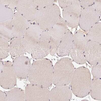 Immunohistochemistry-Paraffin: CTTNBP2 Antibody [NBP2-32030]