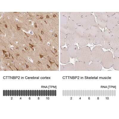 Immunohistochemistry-Paraffin: CTTNBP2 Antibody [NBP2-32030]