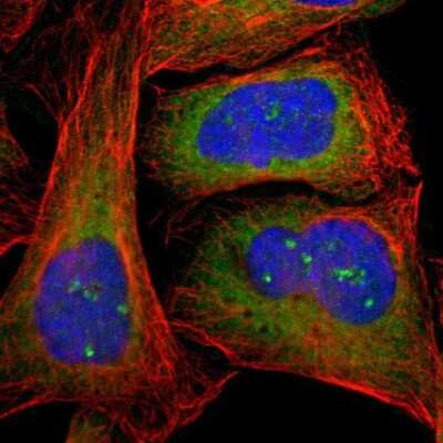 Immunocytochemistry/ Immunofluorescence: CTTNBP2NL Antibody [NBP1-84171]