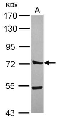 Western Blot: CTTNBP2NL Antibody [NBP2-16032]