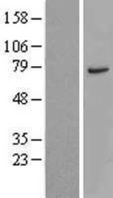 Western Blot: CTTNBP2NL Overexpression Lysate [NBL1-09602]